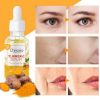 Picture of Upgrade Turmeric Dark Spot Corrector Serum, Natural Turmeric Dark Spot Skin Care Moisturizing Repair Serum